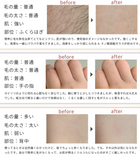 HIBIKURA ナノガラス脱毛パッド 5