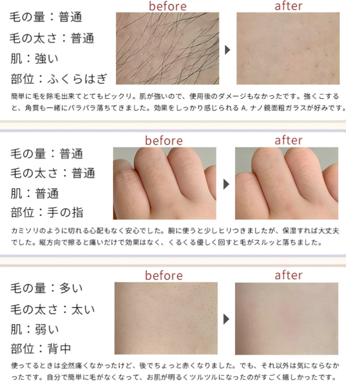 HIBIKURA ナノガラス脱毛パッド 5